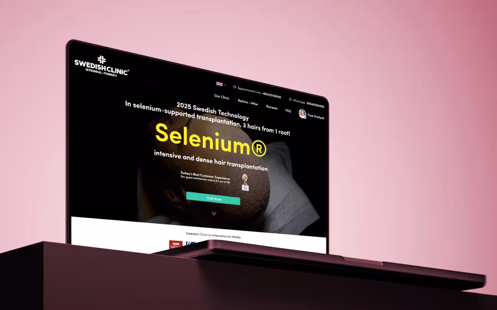 Swedish Clinic (İsveç Klinik) – Estetik ve Saç Ekimi Web Sitesi - Landing Page Tasarım Swedish Clinic (İsveç Klinik) web sitesi WordPress arayüz tasarımı (Swedish Clinic)