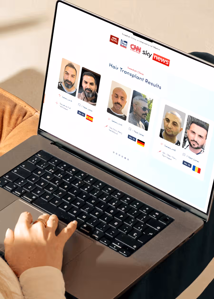 isvecklinik-img2 Isvecklinik img2